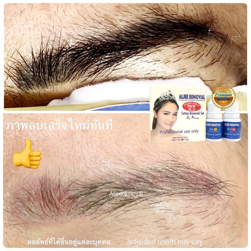 ลบคิ้ว แอลจี้ 3in1